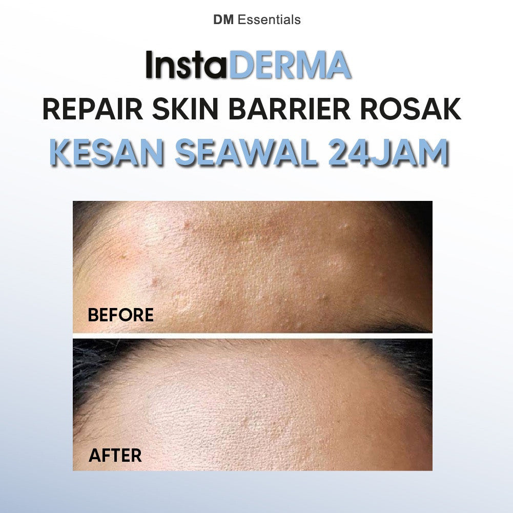 DM Essentials InstaDerma Repair Damaged Skin Barrier Trial Set