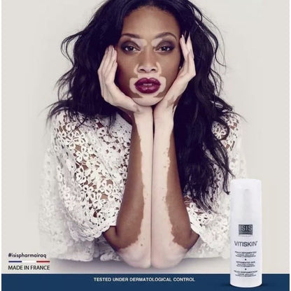 Isispharma Vitiskin 50ML ( Vitiligo / Re-Pigmentations)