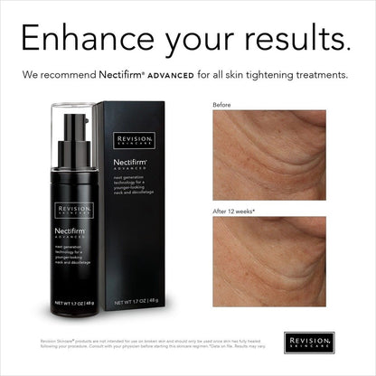 Nectifirm Advanced Neck Cream 48G