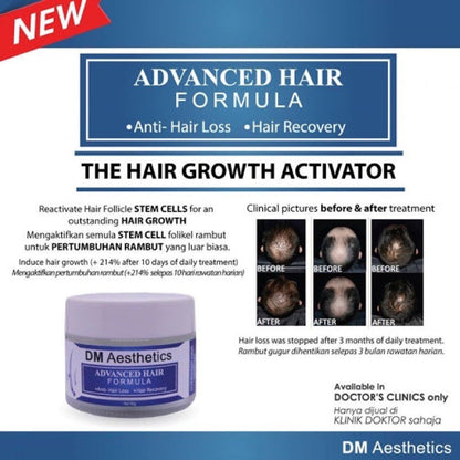 DM Aesthetics Advanced Hair Formula Serum 40G