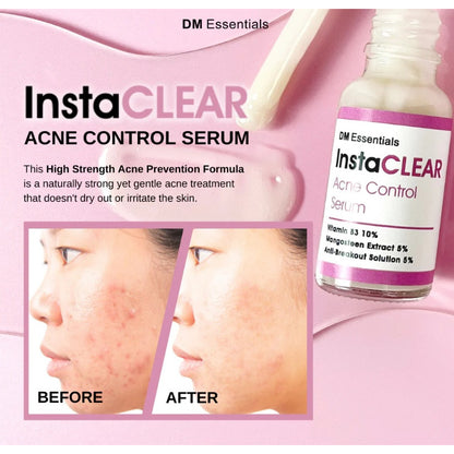 <Expire June 2026> DM Essentials InstaCLEAR Acne Control Serum 20ML <Expire June 2026> Clearance