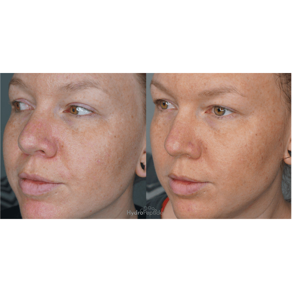 Hydropeptide LumaPro-C Face Serum 30ML