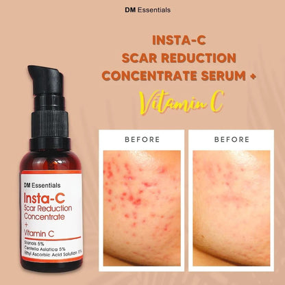DM Essentials Scar Reduction Concentrate + Vitamin C 30ML