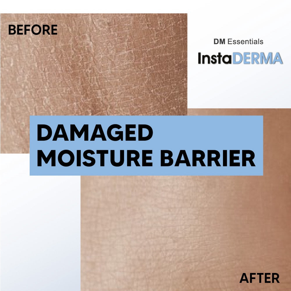 DM Essentials InstaDerma Repair Damaged Skin Barrier Trial Set
