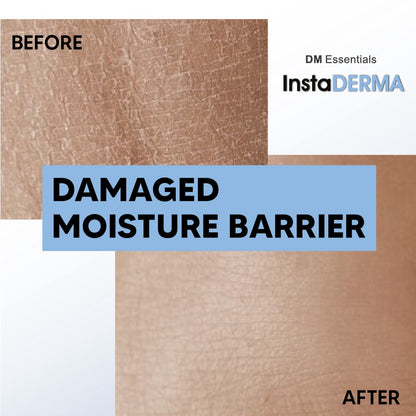 DM Essentials InstaDerma Repair Damaged Skin Barrier Trial Set