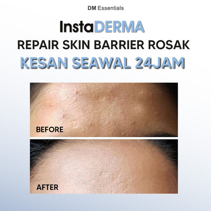 DM Essentials InstaDerma Repair Damaged Skin Barrier Trial Set