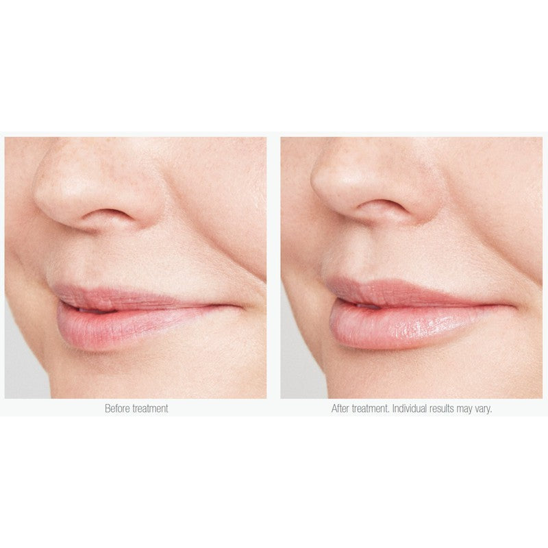 Is Clinical Youth Lip Elixir 3.5G