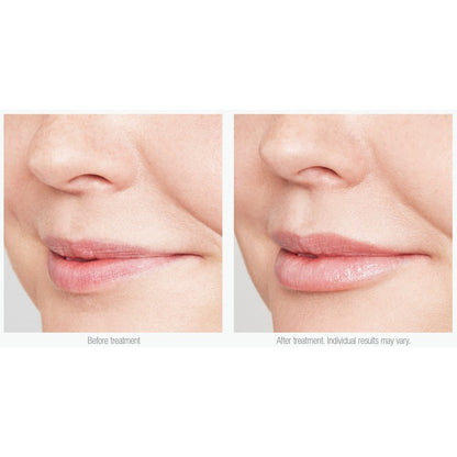 Is Clinical Youth Lip Elixir 3.5G