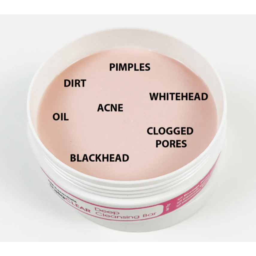 DM Essentials InstaCLEAR Deep Cleansing Bar 75G Sabun Acne Pimple Jerawat Blemish Blackhead Whitehead Remover Soap